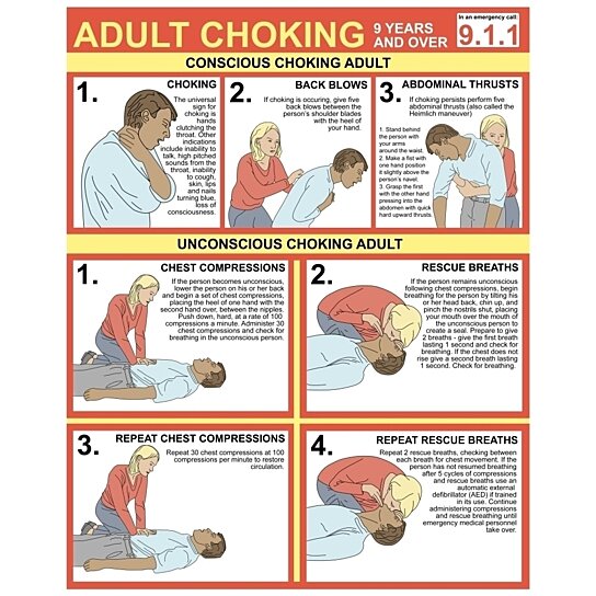 Buy Choking First Aid Chart Poster Print by Gwen Shockey/Science Source ...